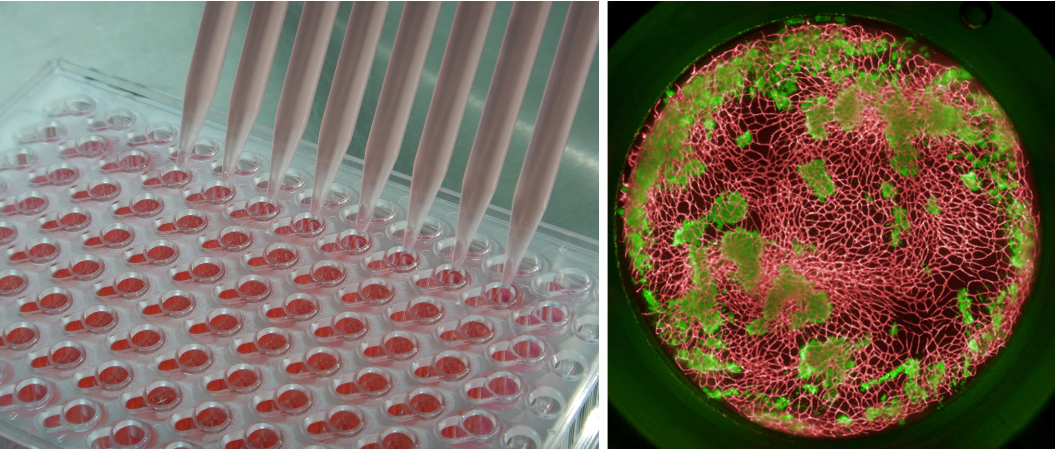 Cancer patient avatar created using invivoid™. Areas shown in green are colorectal cancer cells derived from patient cancer tissue samples while red parts are capillaries. ©TOPPAN Holdings Inc.